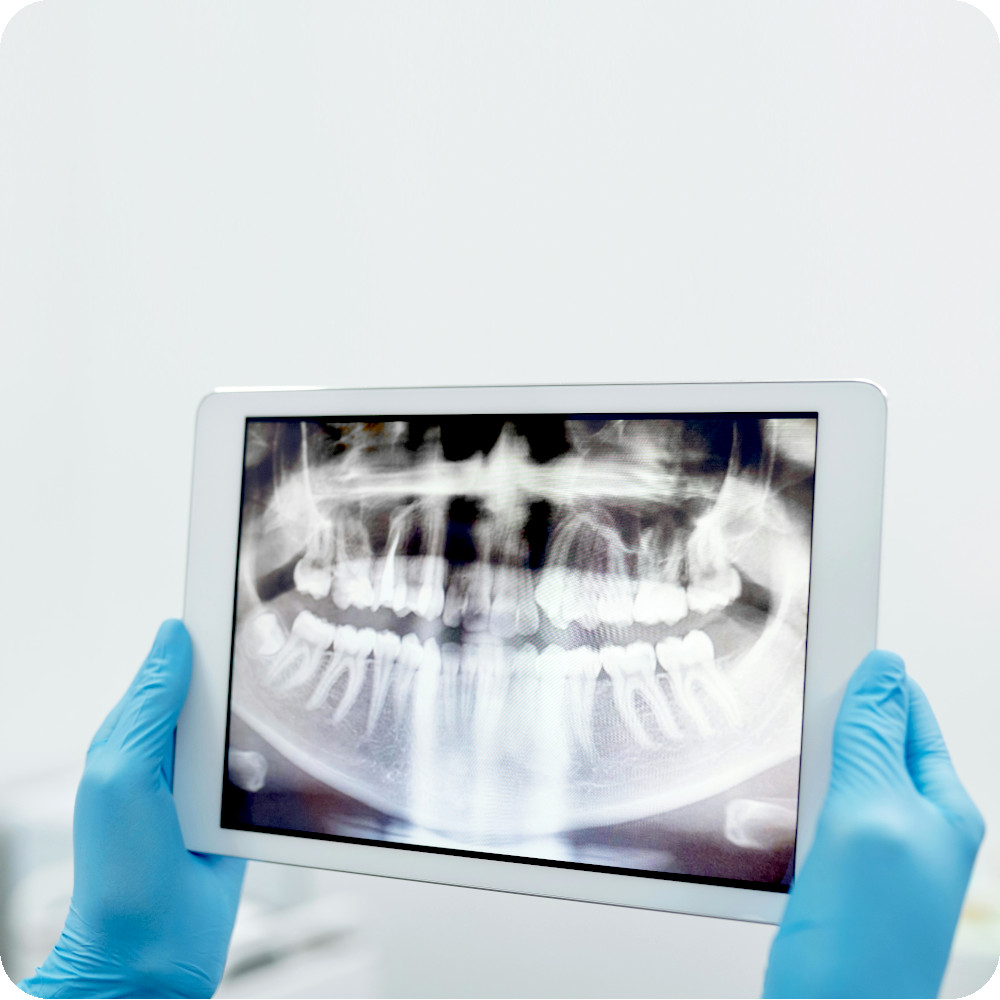 Diemel Dental - Behandelplannen