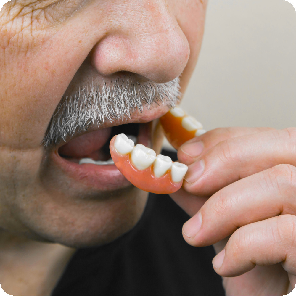 Diemel Dental - Second opinion